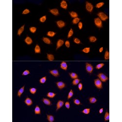 Rabphilin-3A-Like Protein (RPH3AL) Antibody