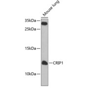 Western blot analysis of various lysates using CRIP1 Antibody at 1/1000 dilution. Secondary antibody: HRP-conjugated Goat anti-Rabbit IgG (H+L) at 1/10000 dilution. Lysates / proteins: 25 µg per lane. Blocking buffer: 3 % nonfat dry milk in TBST. Detection: ECL Basic Kit (RM00020). Exposure time: 180s.