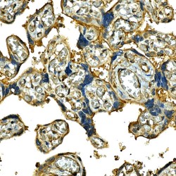 Integrin Alpha 2 (ITGA2) Antibody