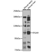 Western blot analysis of various lysates using ITGA9 Antibody at 1/1000 dilution. Secondary antibody: HRP-conjugated Goat anti-Rabbit IgG (H+L) at 1/10000 dilution. Lysates/proteins: 25 µg per lane. Blocking buffer: 3% nonfat dry milk in TBST. Exposure time: 90s.