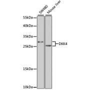 Western blot analysis of various lysates using DKK4 Antibody at 1/1000 dilution. Secondary antibody: HRP-conjugated Goat anti-Rabbit IgG (H+L) at 1/10000 dilution. Lysates/proteins: 25 µg per lane. Blocking buffer: 3% nonfat dry milk in TBST. Exposure time: 90s.