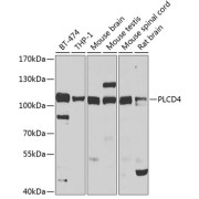 Western blot analysis of various lysates using PLCD4 Antibody at 1/1000 dilution. Secondary antibody: HRP-conjugated Goat anti-Rabbit IgG (H+L) at 1/10000 dilution. Lysates/proteins: 25 µg per lane. Blocking buffer: 3% nonfat dry milk in TBST. Exposure time: 30s.