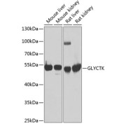 Western blot analysis of various lysates using GLYCTK Antibody at 1/1000 dilution. Secondary antibody: HRP-conjugated Goat anti-Rabbit IgG (H+L) at 1/10000 dilution. Lysates/proteins: 25 µg per lane. Blocking buffer: 3% nonfat dry milk in TBST. Exposure time: 90s.