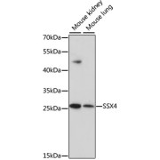 Western blot analysis of various lysates using SSX4 Antibody at 1/1000 dilution. Secondary antibody: HRP-conjugated Goat anti-Rabbit IgG (H+L) at 1/10000 dilution. Lysates/proteins: 25 µg per lane. Blocking buffer: 3% nonfat dry milk in TBST. Exposure time: 90s.