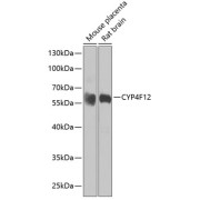 Western blot analysis of various lysates using CYP4F12 Antibody at 1/1000 dilution. Secondary antibody: HRP-conjugated Goat anti-Rabbit IgG (H+L) at 1/10000 dilution. Lysates/proteins: 25 µg per lane. Blocking buffer: 3% nonfat dry milk in TBST. Exposure time: 30s.