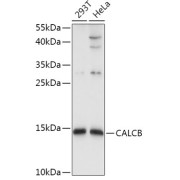 Western blot analysis of various lysates using CALCB Antibody at 1/1000 dilution. Secondary antibody: HRP-conjugated Goat anti-Rabbit IgG (H+L) at 1/10000 dilution. Lysates/proteins: 25 µg per lane. Blocking buffer: 3% nonfat dry milk in TBST. Exposure time: 5s.