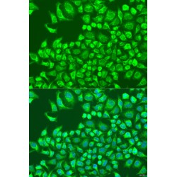 Cystatin-M (CST6) Antibody