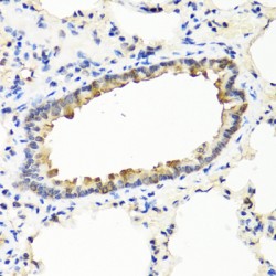 Interferon Omega-1 (IFNW1) Antibody