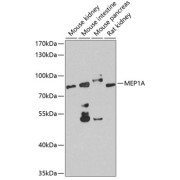 Western blot analysis of various lysates using MEP1A Antibody at 1/1000 dilution. Secondary antibody: HRP-conjugated Goat anti-Rabbit IgG (H+L) at 1/10000 dilution. Lysates/proteins: 25 µg per lane. Blocking buffer: 3% nonfat dry milk in TBST. Exposure time: 90s.
