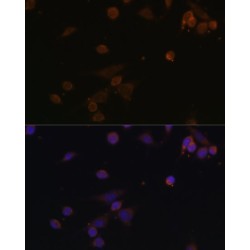 NADH Ubiquinone Oxidoreductase Subunit A2 (NDUFA2) Antibody