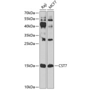 Western blot analysis of various lysates using CST7 Antibody at 1/1000 dilution. Secondary antibody: HRP-conjugated Goat anti-Rabbit IgG (H+L) at 1/10000 dilution. Lysates/proteins: 25 µg per lane. Blocking buffer: 3% nonfat dry milk in TBST. Exposure time: 90s.