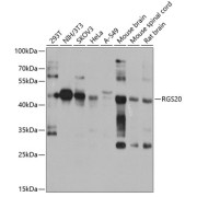 Western blot analysis of various lysates using RGS20 Antibody at 1/1000 dilution. Secondary antibody: HRP-conjugated Goat anti-Rabbit IgG (H+L) at 1/10000 dilution. Lysates/proteins: 25 µg per lane. Blocking buffer: 3% nonfat dry milk in TBST. Exposure time: 15s.