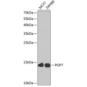 Western blot analysis of various lysates using POP7 Antibody at 1/1000 dilution. Secondary antibody: HRP-conjugated Goat anti-Rabbit IgG (H+L) at 1/10000 dilution. Lysates/proteins: 25 µg per lane. Blocking buffer: 3% nonfat dry milk in TBST. Exposure time: 90s.