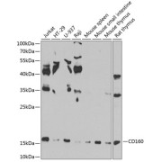 Western blot analysis of various lysates using CD160 Antibody at 1/1000 dilution. Secondary antibody: HRP-conjugated Goat anti-Rabbit IgG (H+L) at 1/10000 dilution. Lysates/proteins: 25 µg per lane. Blocking buffer: 3% nonfat dry milk in TBST. Exposure time: 90s.