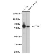Western blot analysis of various lysates using ARFGAP3 Antibody at 1/1000 dilution. Secondary antibody: HRP-conjugated Goat anti-Rabbit IgG (H+L) at 1/10000 dilution. Lysates/proteins: 25 µg per lane. Blocking buffer: 3% nonfat dry milk in TBST. Exposure time: 30s.