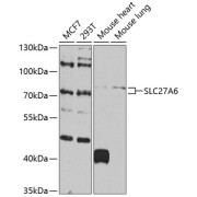 Western blot analysis of various lysates using SLC27A6 Antibody at 1/1000 dilution. Secondary antibody: HRP-conjugated Goat anti-Rabbit IgG (H+L) at 1/10000 dilution. Lysates/proteins: 25 µg per lane. Blocking buffer: 3% nonfat dry milk in TBST. Exposure time: 90s.