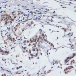 Serrate RNA Effector Molecule Homolog (SRRT) Antibody