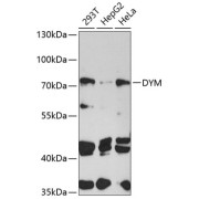 Western blot analysis of various lysates using DYM Antibody at 1/1000 dilution. Secondary antibody: HRP-conjugated Goat anti-Rabbit IgG (H+L) at 1/10000 dilution. Lysates/proteins: 25 µg per lane. Blocking buffer: 3% nonfat dry milk in TBST. Exposure time: 90s.