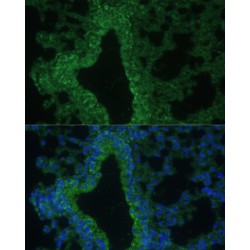 Interleukin 25 (IL25) Antibody