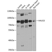 Western blot analysis of various lysates using HAUS3 Antibody at 1/1000 dilution. Secondary antibody: HRP-conjugated Goat anti-Rabbit IgG (H+L) at 1/10000 dilution. Lysates/proteins: 25 µg per lane. Blocking buffer: 3% nonfat dry milk in TBST. Exposure time: 60s.