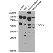 Western blot analysis of various lysates using PDGFD Antibody at 1/1000 dilution. Secondary antibody: HRP-conjugated Goat anti-Rabbit IgG (H+L) at 1/10000 dilution. Lysates/proteins: 25 µg per lane. Blocking buffer: 3% nonfat dry milk in TBST. Exposure time: 90s.