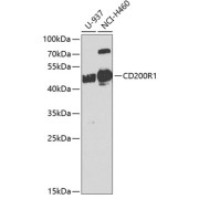 Western blot analysis of various lysates using CD200R1 Antibody at 1/1000 dilution. Secondary antibody: HRP-conjugated Goat anti-Rabbit IgG (H+L) at 1/10000 dilution. Lysates/proteins: 25 µg per lane. Blocking buffer: 3% nonfat dry milk in TBST. Exposure time: 90s.
