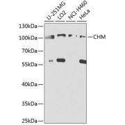 Western blot analysis of various lysates using CHM Antibody at 1/1000 dilution. Secondary antibody: HRP-conjugated Goat anti-Rabbit IgG (H+L) at 1/10000 dilution. Lysates/proteins: 25 µg per lane. Blocking buffer: 3% nonfat dry milk in TBST. Exposure time: 5s.