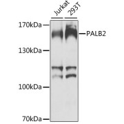 abx005815