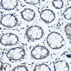 Nuclear Receptor Corepressor 2 (NCOR2) Antibody