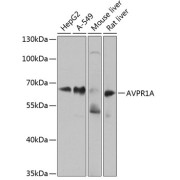 abx005826