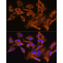 Vasopressin V1a Receptor (AVPR1A) Antibody
