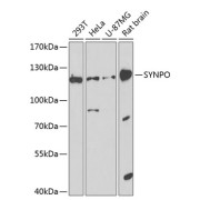 Western blot analysis of various lysates using SYNPO Antibody at 1/1000 dilution. Secondary antibody: HRP-conjugated Goat anti-Rabbit IgG (H+L) at 1/10000 dilution. Lysates/proteins: 25 µg per lane. Blocking buffer: 3% nonfat dry milk in TBST. Exposure time: 90s.