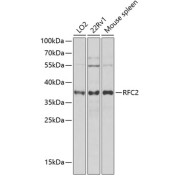 Western blot analysis of various lysates using RFC2 Antibody at 1/1000 dilution. Secondary antibody: HRP-conjugated Goat anti-Rabbit IgG (H+L) at 1/10000 dilution. Lysates/proteins: 25 µg per lane. Blocking buffer: 3% nonfat dry milk in TBST. Exposure time: 5s.