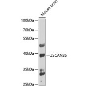 Western blot analysis of lysates from mouse brain, using ZSCAN26 Antibody at 1/1000 dilution. Secondary antibody: HRP-conjugated Goat anti-Rabbit IgG (H+L) at 1/10000 dilution. Lysates/proteins: 25 µg per lane. Blocking buffer: 3% nonfat dry milk in TBST. Exposure time: 90s.