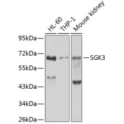 Western blot analysis of various lysates using SGK3 Antibody at 1/1000 dilution. Secondary antibody: HRP-conjugated Goat anti-Rabbit IgG (H+L) at 1/10000 dilution. Lysates/proteins: 25 µg per lane. Blocking buffer: 3% nonfat dry milk in TBST. Exposure time: 10s.