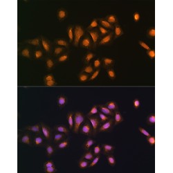Serine/Threonine Kinase 38 (STK38) Antibody