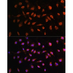 Serine/Threonine Kinase 38 (STK38) Antibody