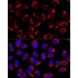 AP-1 Complex Subunit Mu-2 (AP1M2) Antibody