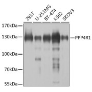 Western blot analysis of various lysates using PPP4R1 Antibody at 1/1000 dilution. Secondary antibody: HRP-conjugated Goat anti-Rabbit IgG (H+L) at 1/10000 dilution. Lysates/proteins: 25 µg per lane. Blocking buffer: 3% nonfat dry milk in TBST. Exposure time: 5s.
