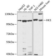 Western blot analysis of various lysates using HK3 Antibody at 1/1000 dilution. Secondary antibody: HRP-conjugated Goat anti-Rabbit IgG (H+L) at 1/10000 dilution. Lysates/proteins: 25 µg per lane. Blocking buffer: 3% nonfat dry milk in TBST. Exposure time: 10s.