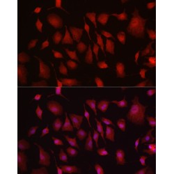 Hexokinase 3 (HK3) Antibody