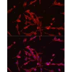 Hexokinase 3 (HK3) Antibody