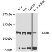 Western blot analysis of various lysates using PDE3B Antibody at 1/1000 dilution. Secondary antibody: HRP-conjugated Goat anti-Rabbit IgG (H+L) at 1/10000 dilution. Lysates/proteins: 25 µg per lane. Blocking buffer: 3% nonfat dry milk in TBST. Exposure time: 40s.