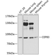 Western blot analysis of various lysates using CEP83 Antibody at 1/1000 dilution. Secondary antibody: HRP-conjugated Goat anti-Rabbit IgG (H+L) at 1/10000 dilution. Lysates/proteins: 25 µg per lane. Blocking buffer: 3% nonfat dry milk in TBST. Exposure time: 90s.