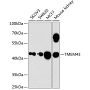 Western blot analysis of various lysates using TMEM43 Antibody at 1/1000 dilution. Secondary antibody: HRP-conjugated Goat anti-Rabbit IgG (H+L) at 1/10000 dilution. Lysates/proteins: 25 µg per lane. Blocking buffer: 3% nonfat dry milk in TBST. Exposure time: 5s.