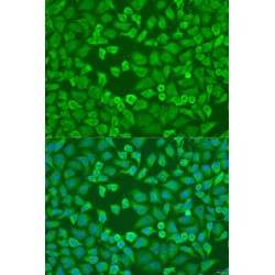 Eukaryotic Translation Initiation Factor 3a (EIF3A) Antibody