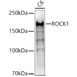 Rho-Associated Protein Kinase 1 (ROCK1) Antibody