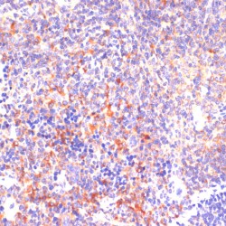 Rho-Associated Protein Kinase 1 (ROCK1) Antibody