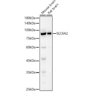 Western blot analysis of various lysates using SLC6A2 Antibody at 1/1000 dilution. Secondary antibody: HRP-conjugated Goat anti-Rabbit IgG (H+L) at 1/10000 dilution. Lysates/proteins: 25 µg per lane. Blocking buffer: 3% nonfat dry milk in TBST. Exposure time: 1s.