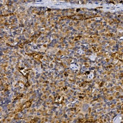 Dipeptidyl Peptidase 4 / CD26 (DPP4) Antibody